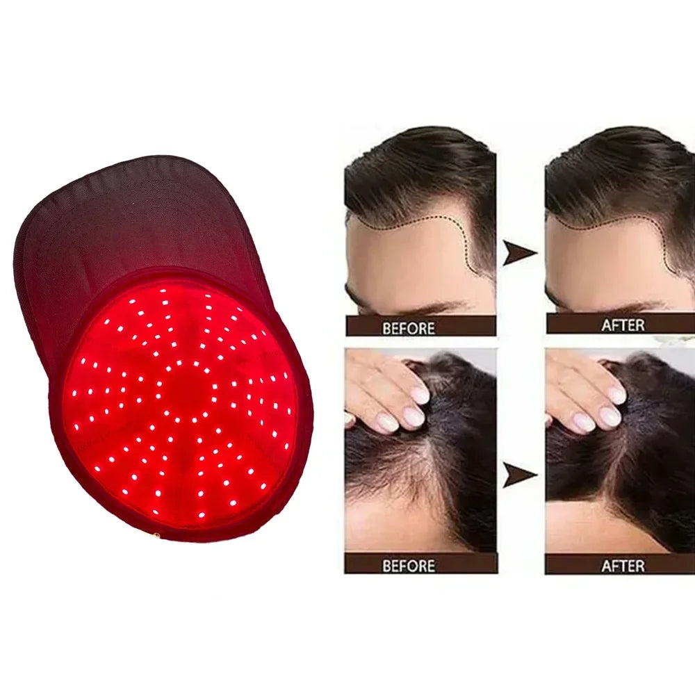 USB-Powered Red Light Scalp Cap with 96 Listed LEDs, 660nm and 850nm Wavelengths, Three Timer Settings and Separate Light Panel Option