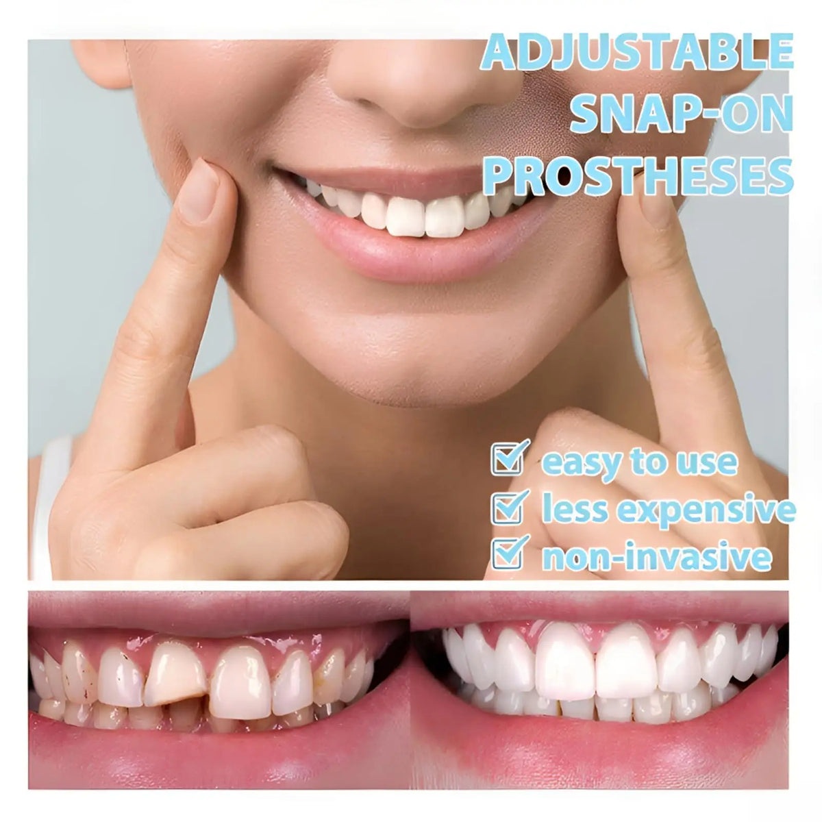 Adjustable Snap-On Teeth Kit with One-, Three- or Five-Box Option Labels for Cosmetic Appearance Consideration, with Dental Suitability and Fit Requiring Review