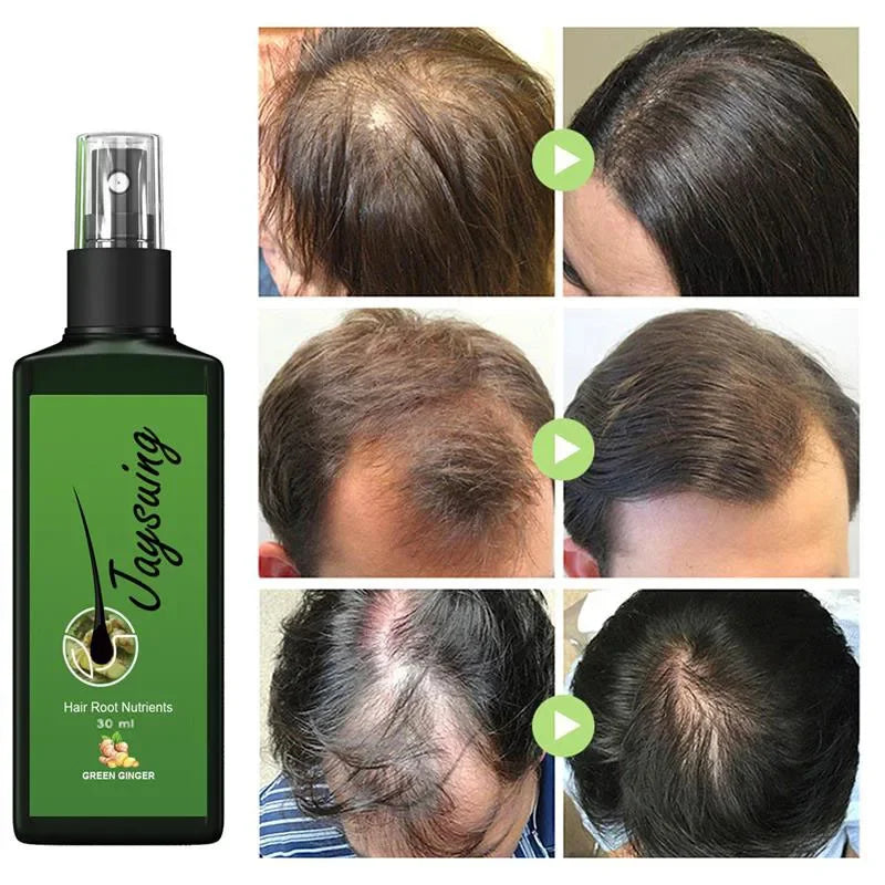 Hair Care Serum with Ginger Reference, Listed 30ml Scalp and Hair Grooming Product for Men and Women, At-Home Personal Care Routine