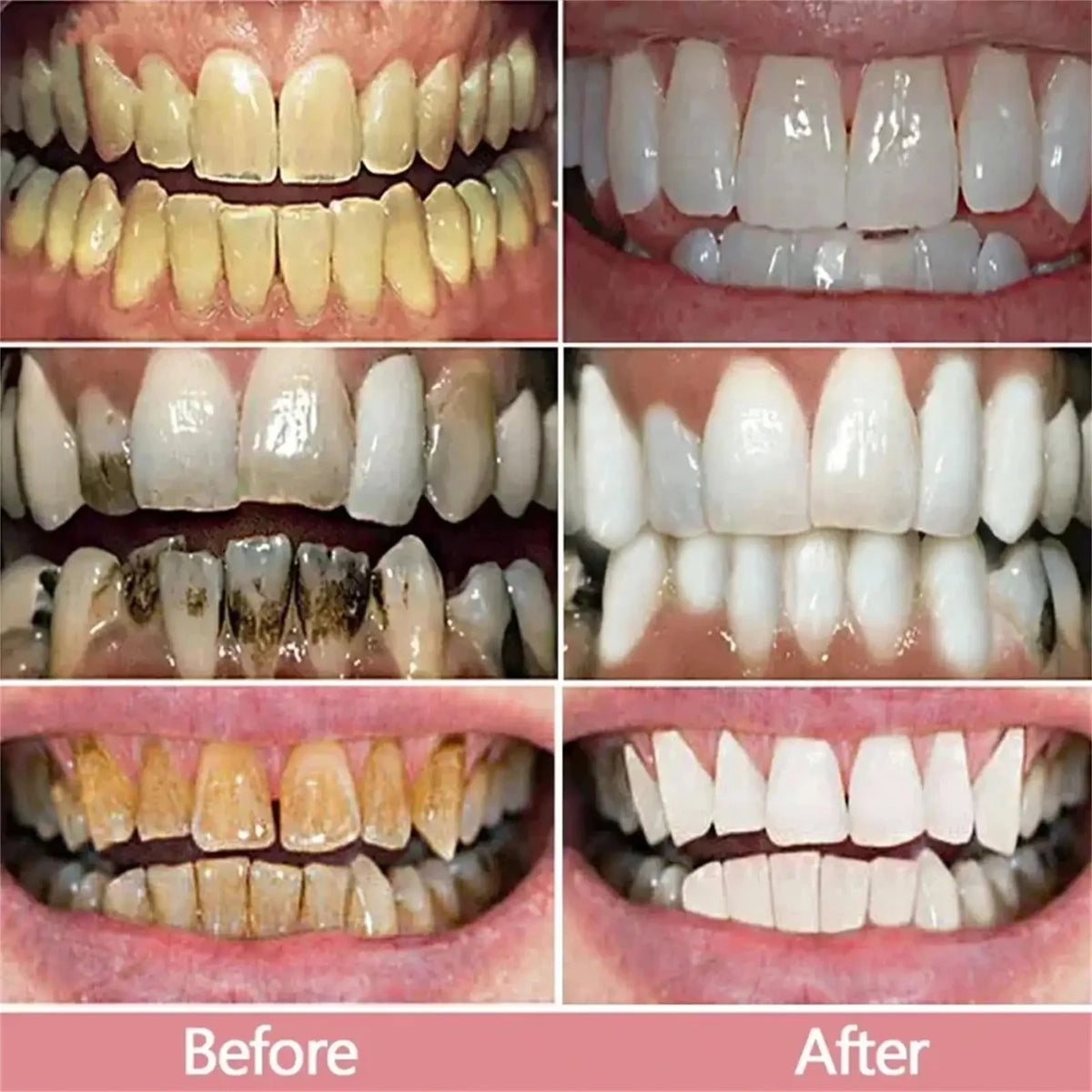 V34 Purple Toothpaste Serum with Color-Correcting Concept, 1-Piece, 2-Piece or Seven-Piece Box Options for Label-Guided Adult Oral Care Routines