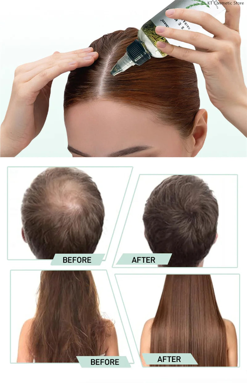 Rosemary Extract Hair Serum, 100ml Cosmetic Scalp and Hair Care with Listed Biotin, Vitamin B5, Coconut and Grape Seed Oils for Men and Women