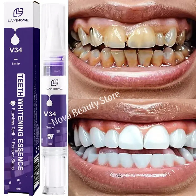 Teeth Whitening Pen with One, Three or Five-Piece Pack Options and Source Gel References for Label-Guided Adult Cosmetic Oral Care Selection