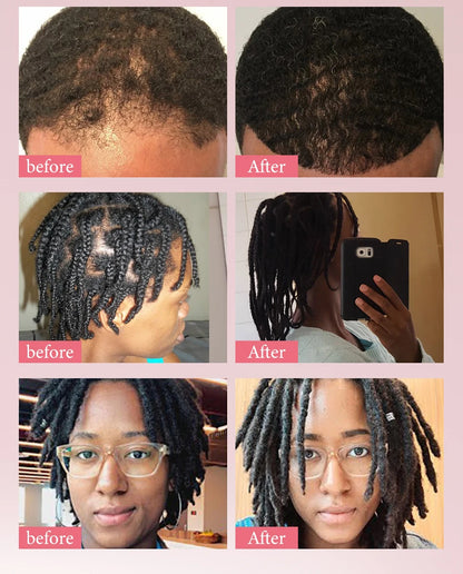 Hair Care Oil and Cream Options with Karkar, Chebe, Batana and Rosemary References, Single 40ml Oil, Single 60g Cream or Set and gift for Cosmetic Grooming