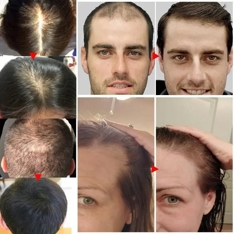 Ginger Hair Oil with Scalp and Shampoo Routine References, Cosmetic Hair Care Serum for Women and Men with Single and Promotional Purchase Options