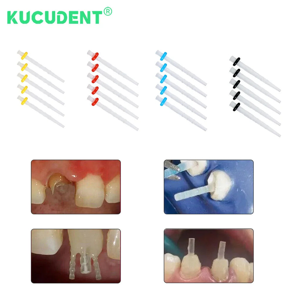 200 Pcs Dental Fiber Post Glass Quartz Straight Screw Teeth Restorative Materials Mixed 1.2 1.4 1.6 1.8mm Endo Root Canal Pile