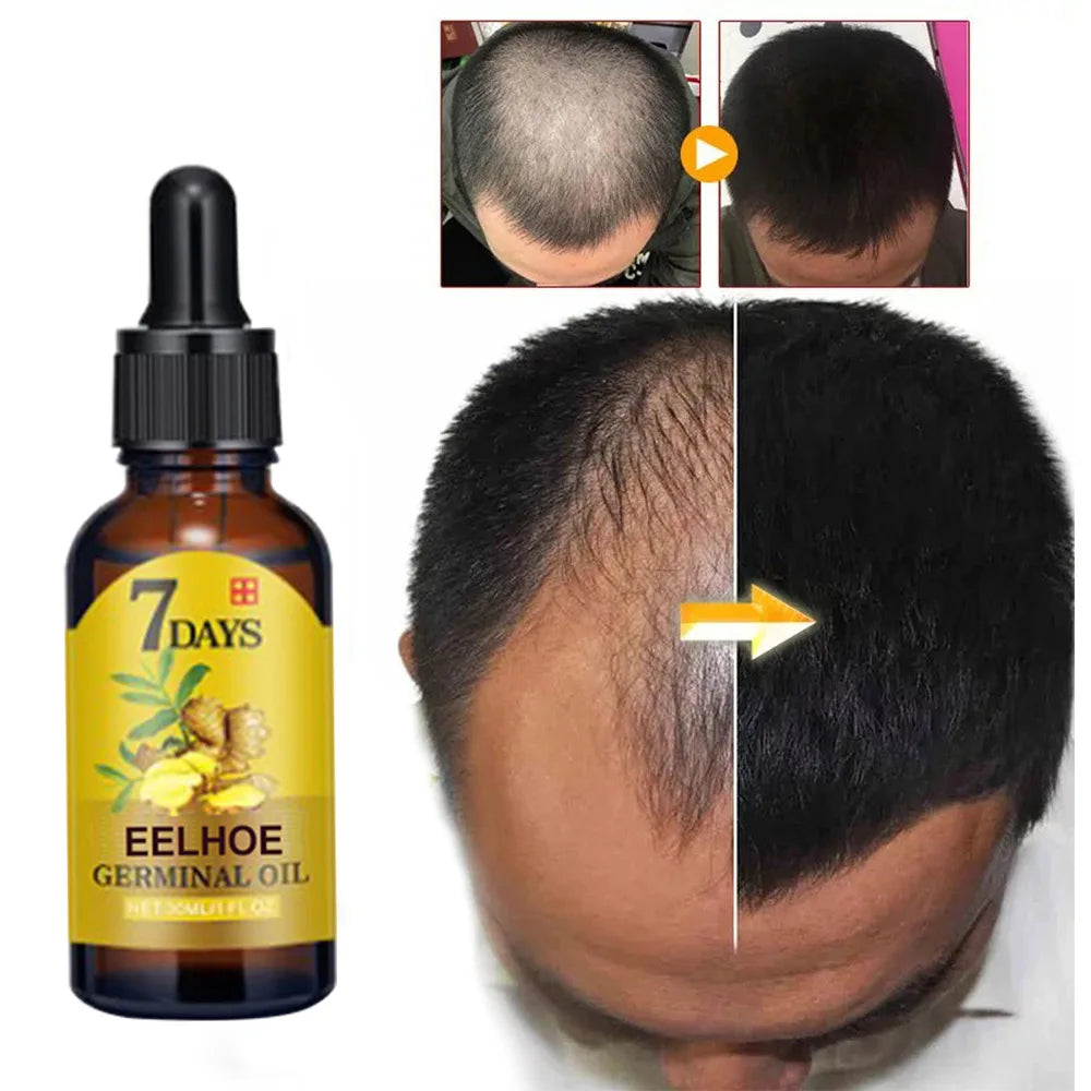 Ginger Hair Oil for Scalp Massage by EELHOE, Cosmetic Hair Care Serum for Men and Women in 10ml, 20ml and 40ml Size Options for At-Home Routines