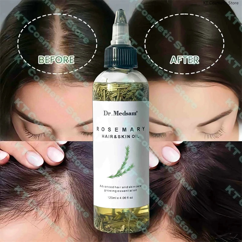Rosemary Extract Hair Serum, 100ml Cosmetic Scalp and Hair Care with Listed Biotin, Vitamin B5, Coconut and Grape Seed Oils for Men and Women
