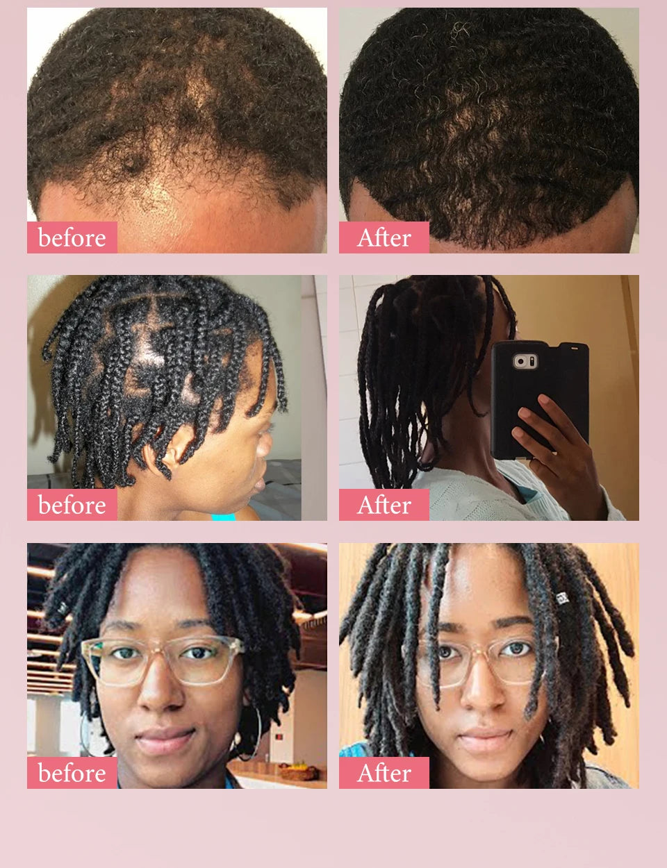 Hair Care Oil and Cream Options with Karkar, Chebe, Batana and Rosemary References, Single 40ml Oil, Single 60g Cream or Set and gift for Cosmetic Grooming