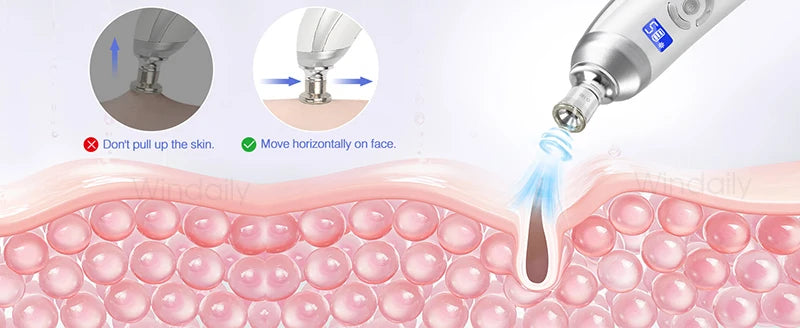 Cordless Diamond Microdermabrasion Device with Replaceable Tip References, Nine-Head Five-Level or Four-Head Three-Level Options for Adult Facial Beauty Routines