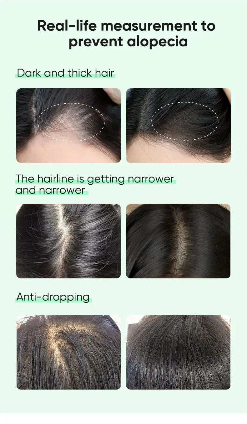 Ginger Hair Oil with Scalp and Shampoo Routine References, Cosmetic Hair Care Serum for Women and Men with Single and Promotional Purchase Options