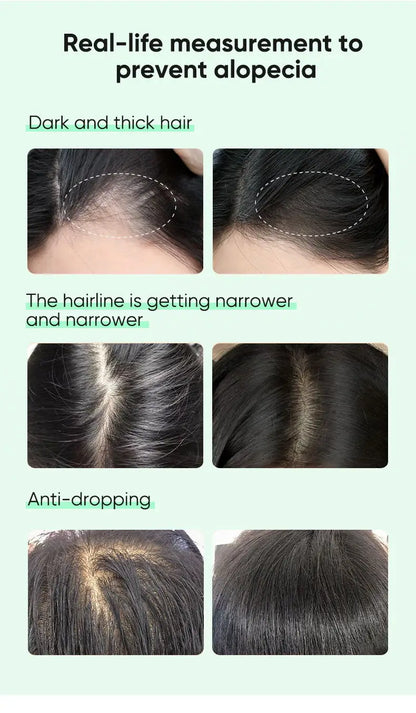 Ginger Hair Oil with Scalp and Shampoo Routine References, Cosmetic Hair Care Serum for Women and Men with Single and Promotional Purchase Options