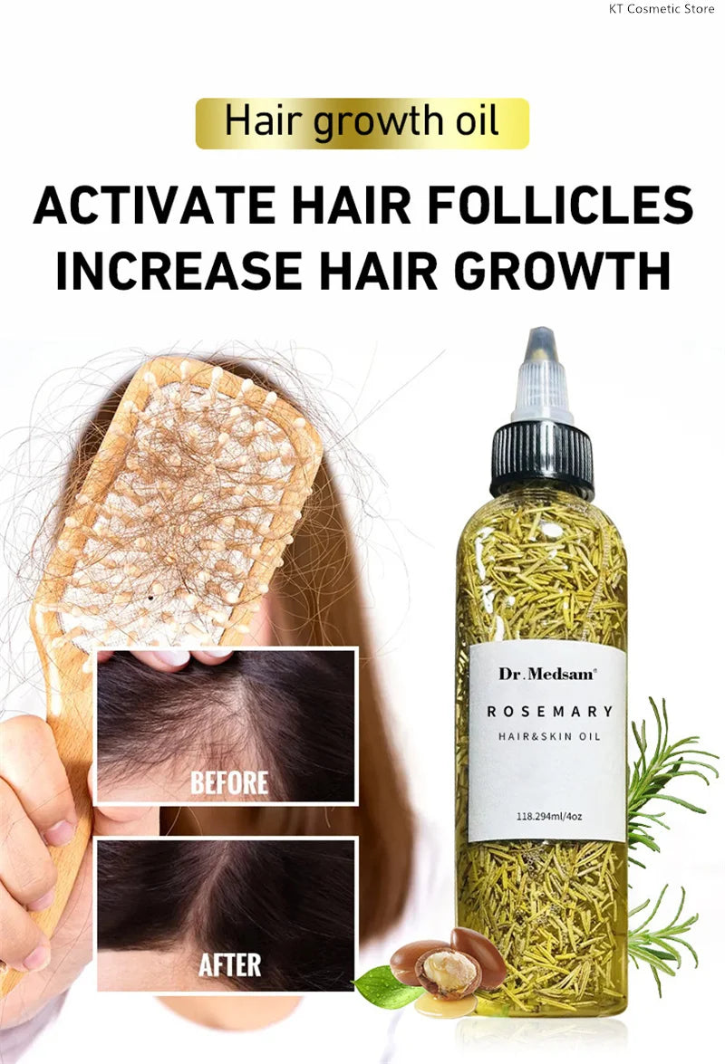 Rosemary Extract Hair Serum, 100ml Cosmetic Scalp and Hair Care with Listed Biotin, Vitamin B5, Coconut and Grape Seed Oils for Men and Women