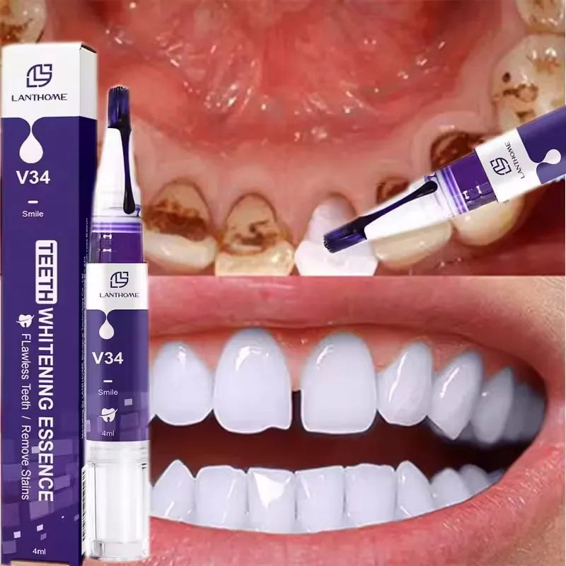 Teeth Whitening Pen with One, Three or Five-Piece Pack Options and Source Gel References for Label-Guided Adult Cosmetic Oral Care Selection