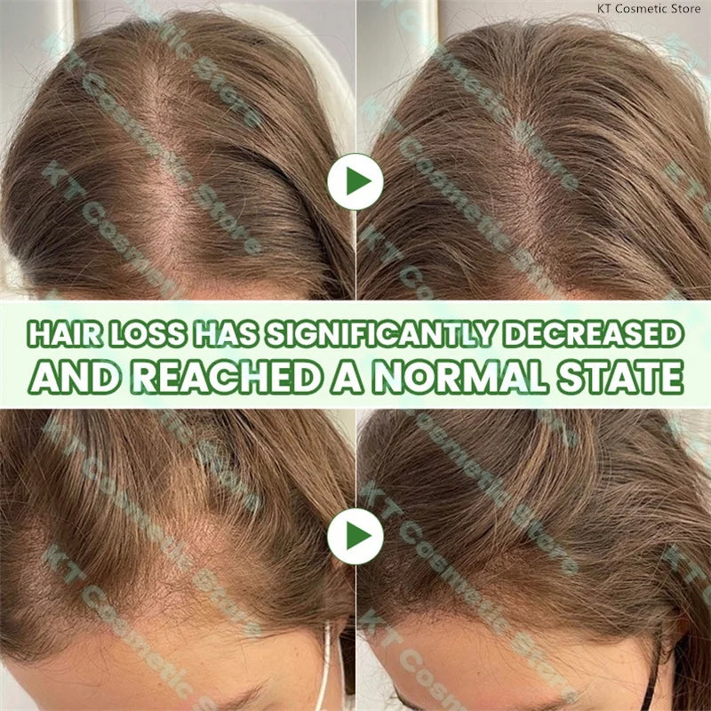 Rosemary Extract Hair Serum, 100ml Cosmetic Scalp and Hair Care with Listed Biotin, Vitamin B5, Coconut and Grape Seed Oils for Men and Women