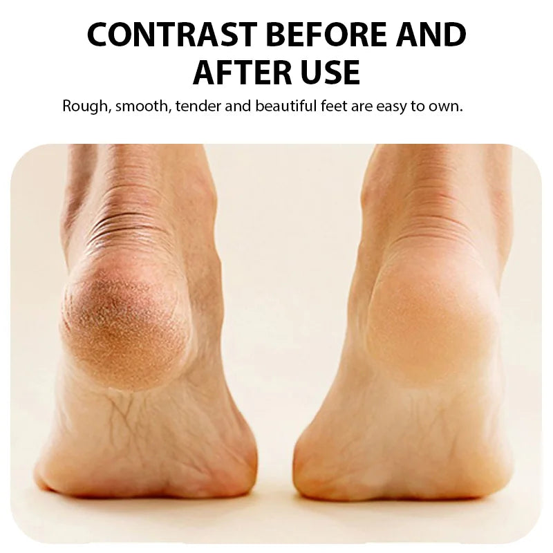 Electric Foot File with Rechargeable Design and Three Grinding Heads, Two Fine and One Coarse Head, White Portable Foot Care Tool for At-Home Pedicure Routines