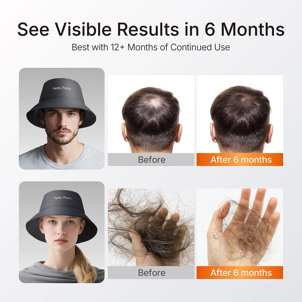 LED Scalp Care Bucket Hat Hello Face T100 with 336 Red and Near-Infrared LEDs, Three Light Modes and Separate With-Controller or Hat-Only Set Options