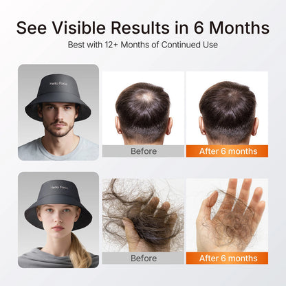 LED Scalp Care Bucket Hat Hello Face T100 with 336 Red and Near-Infrared LEDs, Three Light Modes and Separate With-Controller or Hat-Only Set Options