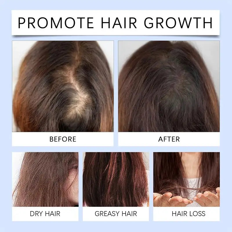 Tea Tree Hair Conditioning Essence with Listed Hyaluronic Acid and Nut Oil, Scalp Massage Hair Care in One, Three or Five-Piece Options