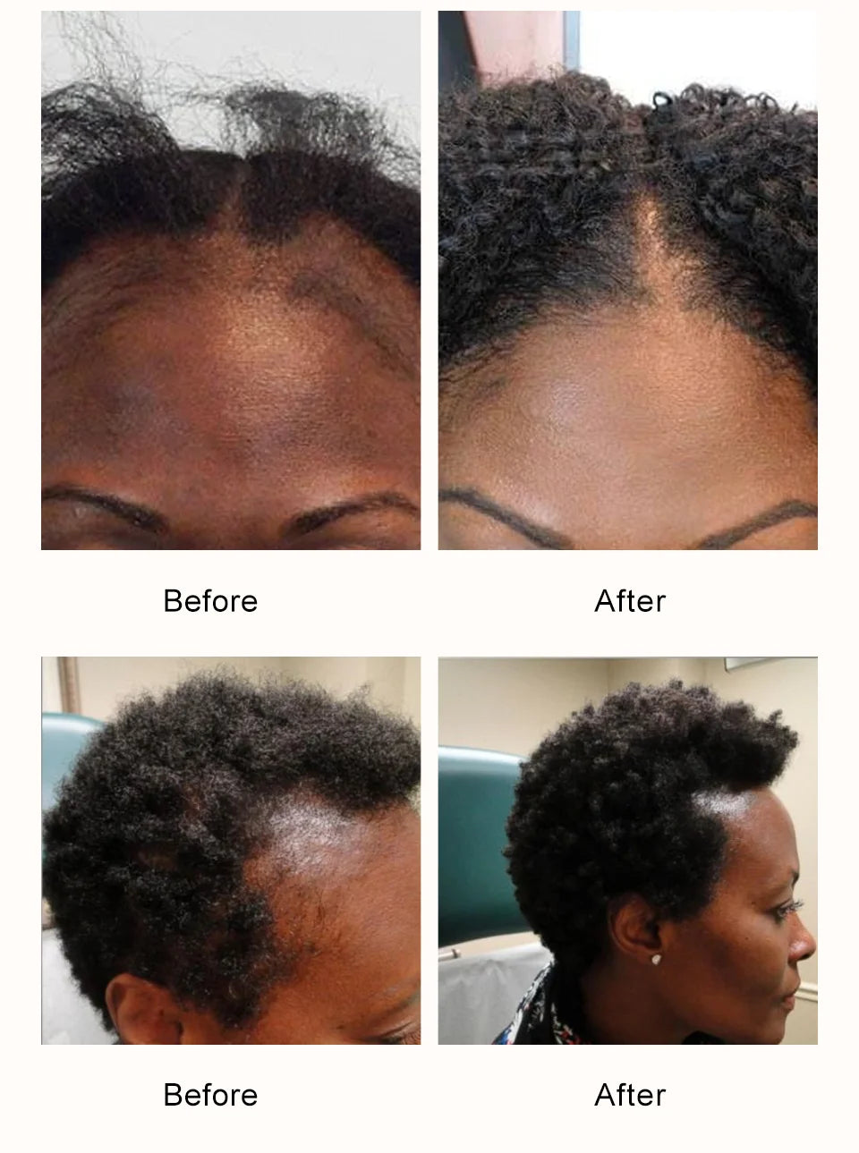 Chebe Hair Powder with One, Two or Three-Piece Pack Options for Label-Guided Cosmetic Hair Care Selection and Personal Routine Planning