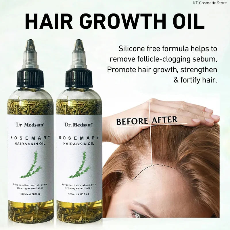 Rosemary Extract Hair Serum, 100ml Cosmetic Scalp and Hair Care with Listed Biotin, Vitamin B5, Coconut and Grape Seed Oils for Men and Women
