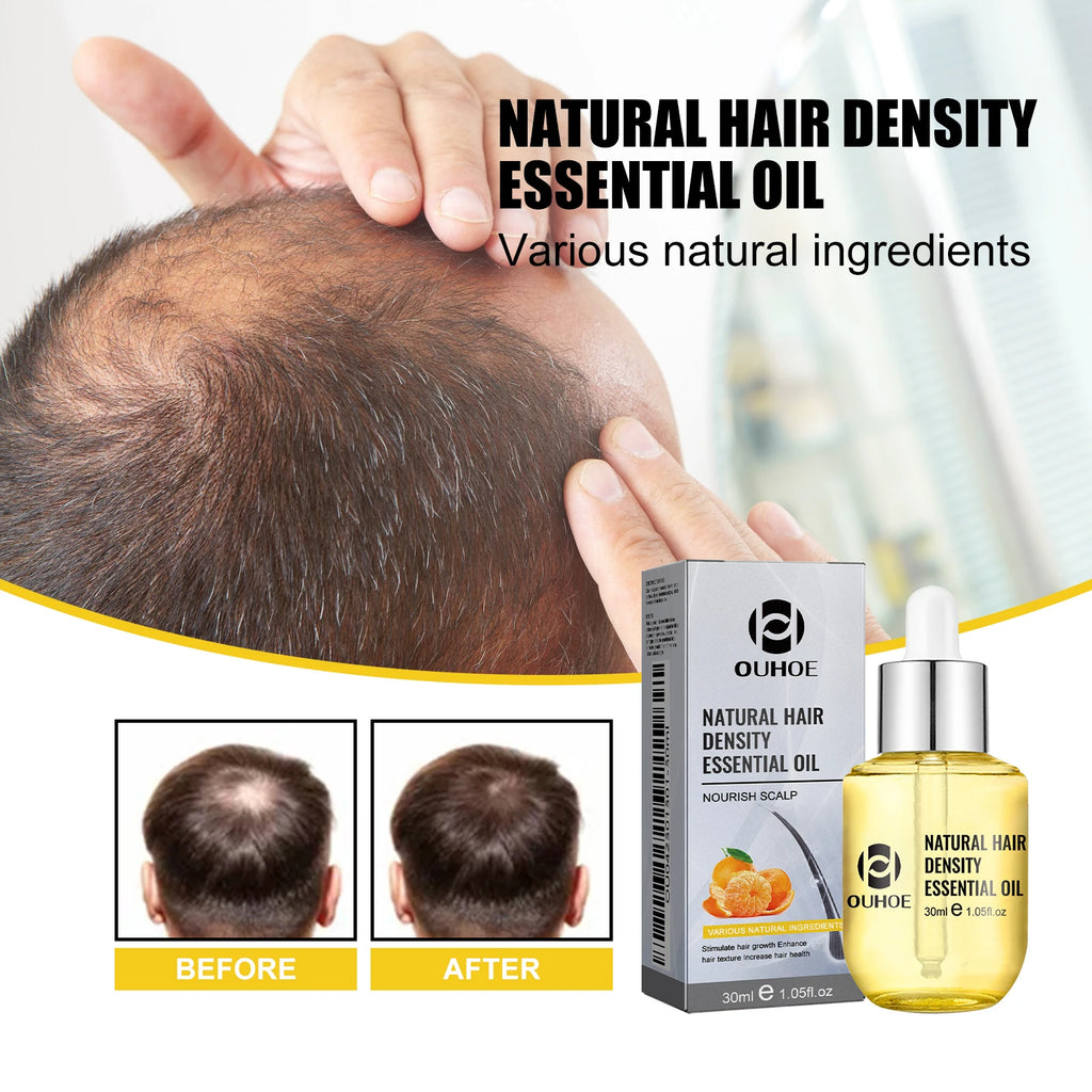 Scalp Massage Hair Oil by OUHOE, 30ml Cosmetic Hair Care with Citrus, Ginger and Ginseng, Dropper Bottle for Men and Women at Home