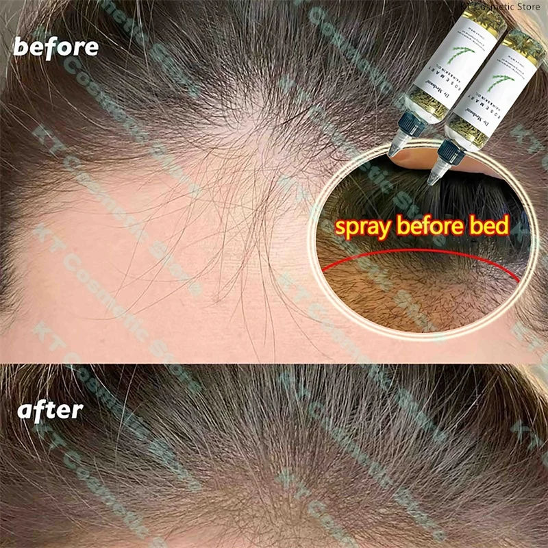 Rosemary Extract Hair Serum, 100ml Cosmetic Scalp and Hair Care with Listed Biotin, Vitamin B5, Coconut and Grape Seed Oils for Men and Women