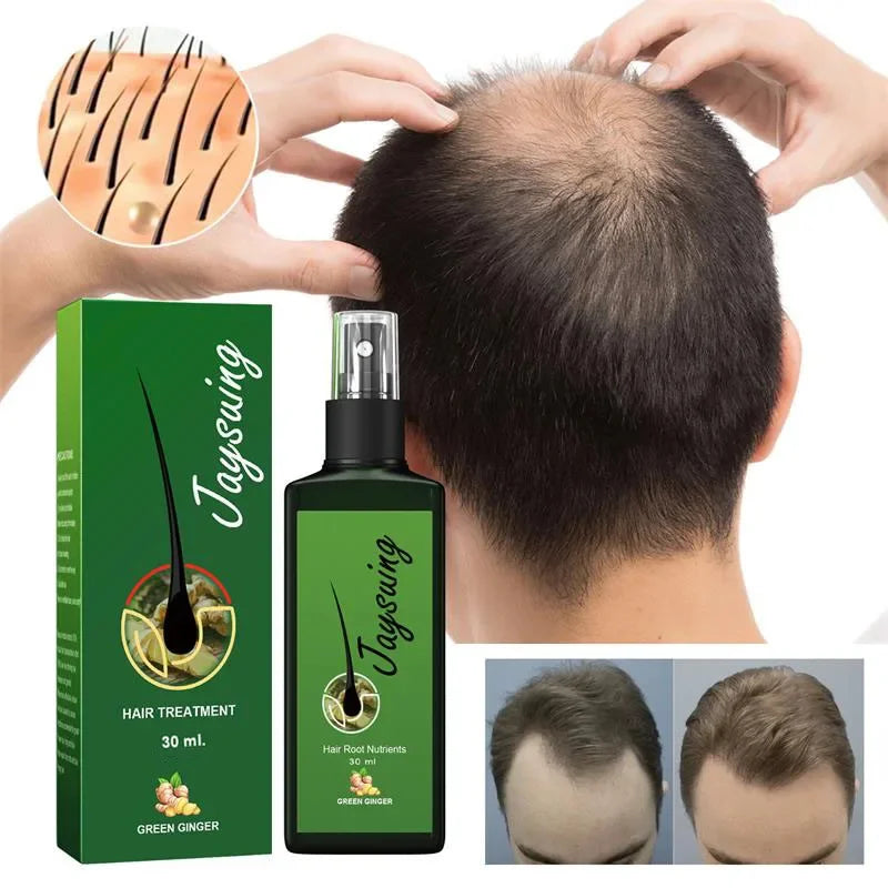 Hair Care Serum with Ginger Reference, Listed 30ml Scalp and Hair Grooming Product for Men and Women, At-Home Personal Care Routine