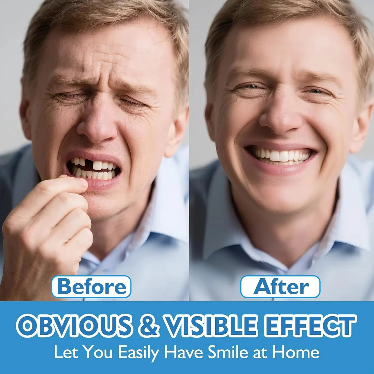 Upper and Lower False Teeth with Listed Silicone Material, Adult Denture-Style Appliance in Single-Item and Bundle Options Requiring Professional Fit Review