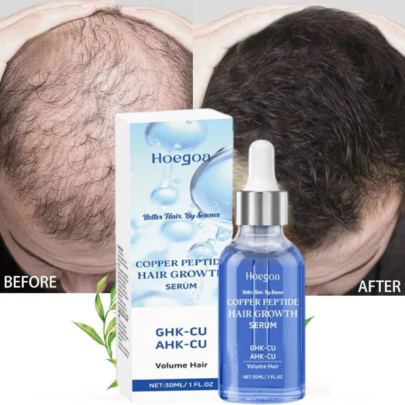 Tea Tree Hair Conditioning Essence with Listed Hyaluronic Acid and Nut Oil, Scalp Massage Hair Care in One, Three or Five-Piece Options