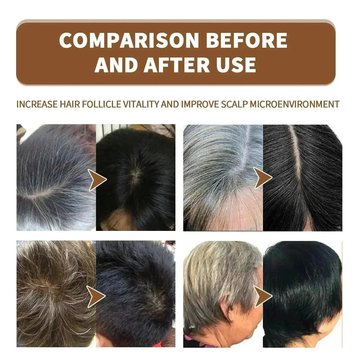 Hair Tonic Liquid for Adult Hair Care Routines, Listed Unscented Formula with Single-Item and Multipack Selections for At-Home Grooming