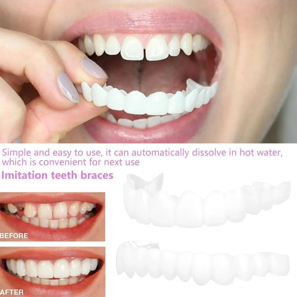 Temporary Cosmetic Teeth Covers, One Upper and Lower Pair with Listed Heat-Moldable Design for Adult Smile Appearance, Dental Fit Review Before Use