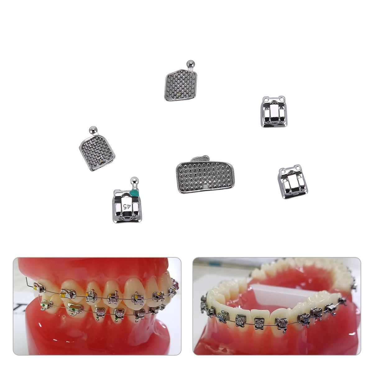 Passive Self-Ligating Brackets by AZDENT, Five Packs with First-Molar Buccal Tubes and Listed 0.022-Inch MBT or Roth Hooks 345 Options for Professional Orthodontic Selection