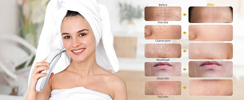Cordless Diamond Microdermabrasion Device with Replaceable Tip References, Nine-Head Five-Level or Four-Head Three-Level Options for Adult Facial Beauty Routines