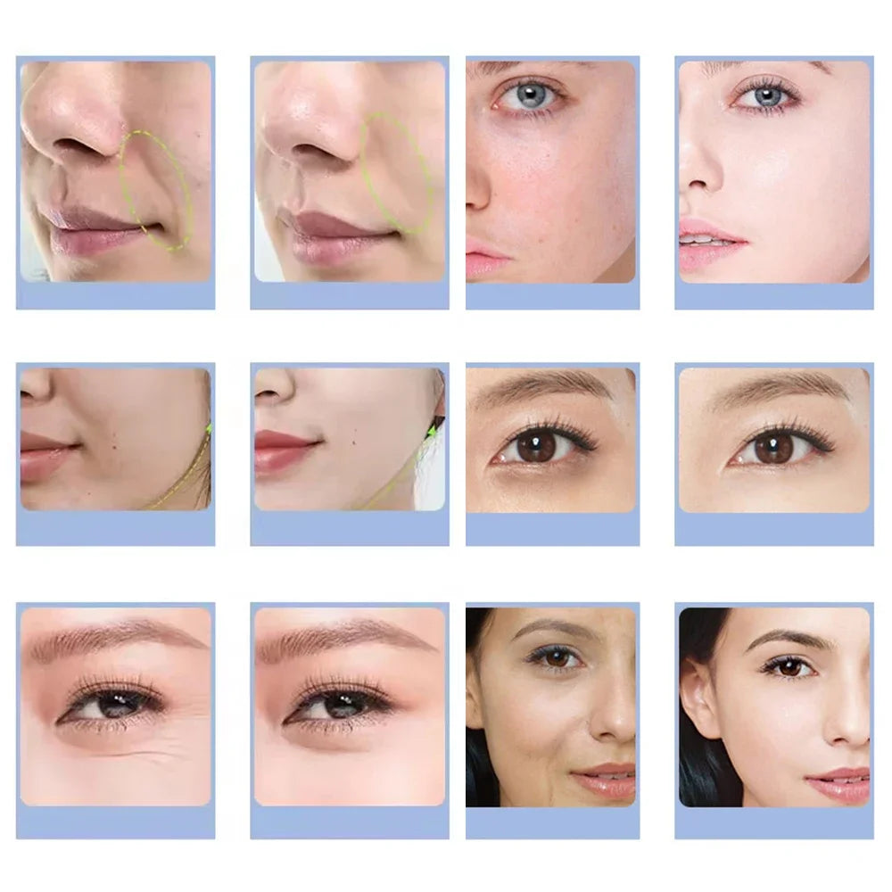 Facial CO2 Bubble Spa Options with Type1-Type7 Capsule, Serum and Gel References, Separate Beauty Machine and Machine NO BOX Selections