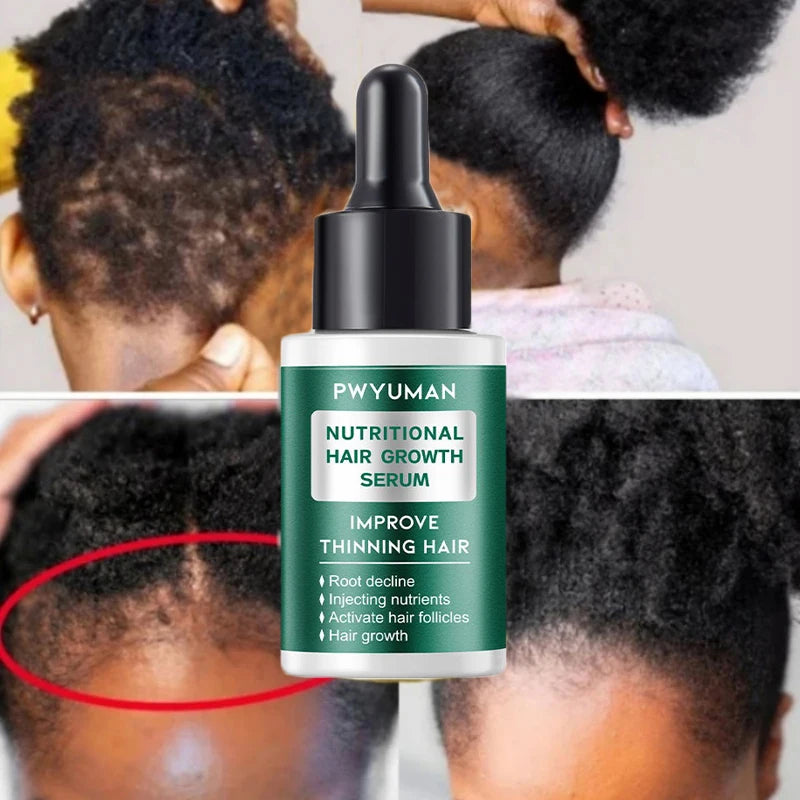 Ginger Hair Oil with Scalp and Shampoo Routine References, Cosmetic Hair Care Serum for Women and Men with Single and Promotional Purchase Options