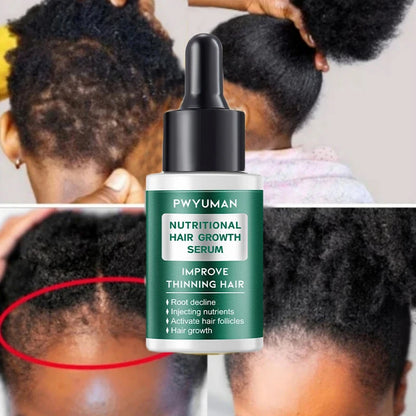 Ginger Hair Oil with Scalp and Shampoo Routine References, Cosmetic Hair Care Serum for Women and Men with Single and Promotional Purchase Options