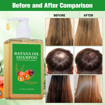 Batana Oil Shampoo Set with Listed Hair Oil, Rosemary Leaf Oil Shampoo Formula for Everyday Cleansing and Cosmetic Hair Conditioning at Home