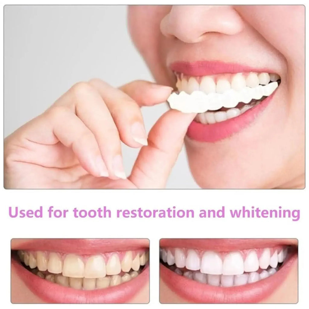 Temporary Cosmetic Teeth Covers, One Upper and Lower Pair with Listed Heat-Moldable Design for Adult Smile Appearance, Dental Fit Review Before Use