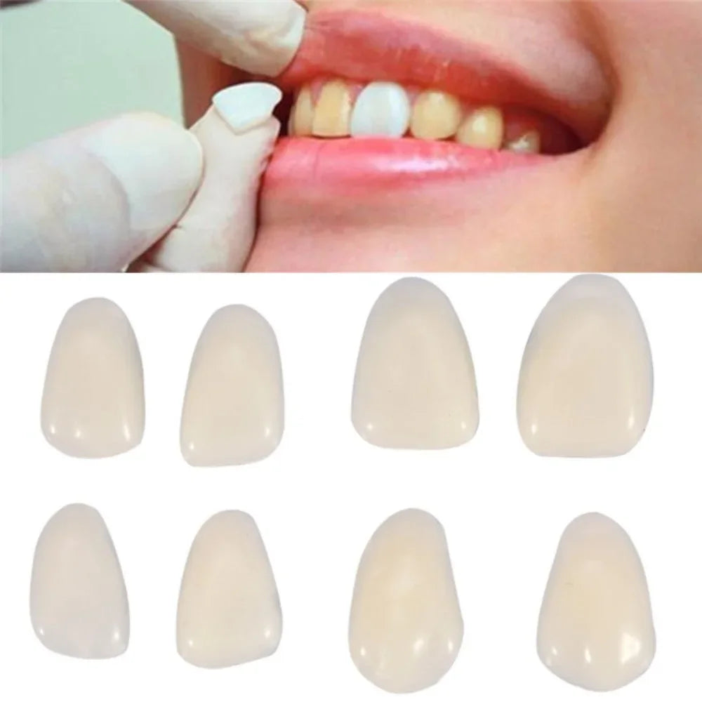 Temporary Dental Veneer Pieces for Front Teeth, Mixed-Size Cosmetic Cover Listing in Slightly White or Slightly Yellow Options for Professional Dental Review